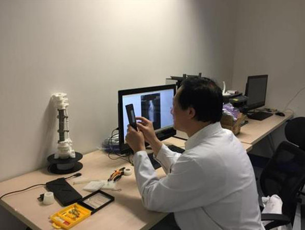 3D打印醫(yī)療應用成功案例 北醫(yī)三院3D打印定制人工椎體植入術