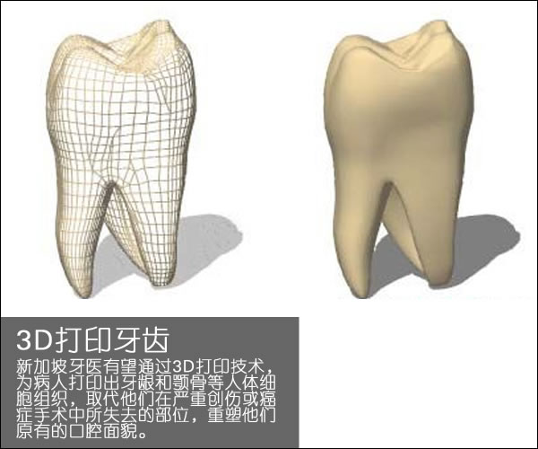 個(gè)性化醫(yī)療3D打印實(shí)戰(zhàn)案例與研究成果的問(wèn)答整理_3d打印服務(wù)公司