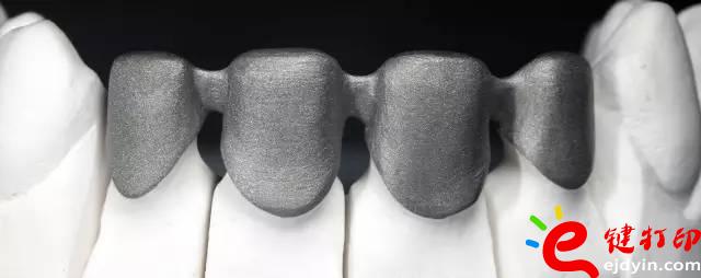 醫(yī)療輔助器械的變革之路 3d打印義齒(假牙)前景無限 勢(shì)在必行_醫(yī)療設(shè)備器械3d模型打印平臺(tái)