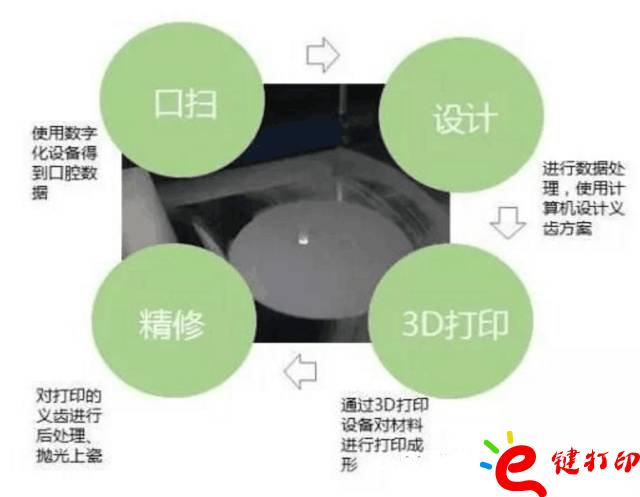 醫(yī)療輔助器械的變革之路 3d打印義齒(假牙)前景無限 勢(shì)在必行_醫(yī)療設(shè)備器械3d模型打印平臺(tái)