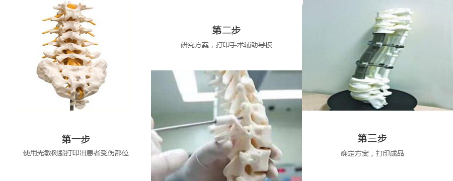 脊椎金屬植入物3d打印制作流程